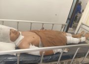 Korban CPO PKS PT SKA Desa Seikuning Terbaring Di RS Awal Bros Sesudah Dilakukan Operasi
