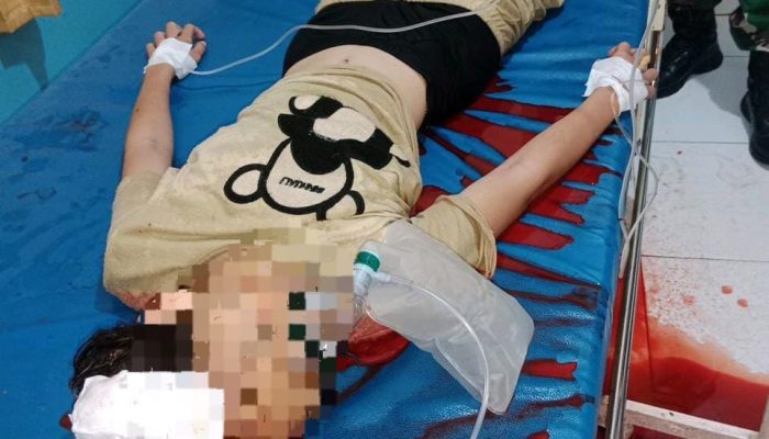 Niat Uji Senjata Berujung Petaka Pelajar Tewas Tertembak Airgun