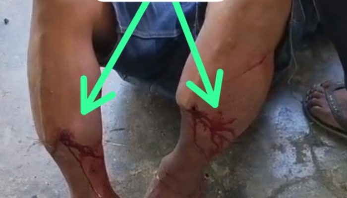 PLN diduga Lalai, Pengendara Alamai Luka Berat